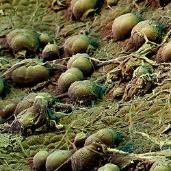 Sweet potato  Field-of-View: 186 x 261 micron : potato, sweet potato, sweet, leaf, underside, hyphen, microbes, starch