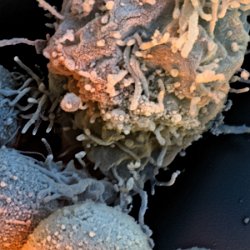 T-Cells  Personalized T-cells to fight Acute Lymphoblastic Leukemia. Specimen courtesy Bruce Levine. Field-of-View: 9x9 micron : t-cell, cell, blood, fight, cancer, lymphoblastic, Bruce Levine, leukemia