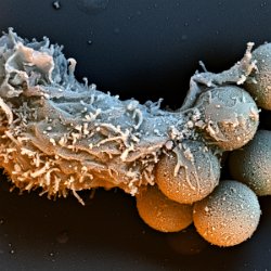 T-Cells  Personalized T-cells to fight Acute Lymphoblastic Leukemia. Specimen courtesy Bruce Levine. Field-of-View: 21x21 micron : t-cell, cell, blood, fight, cancer, lymphoblastic, Bruce Levine, leukemia